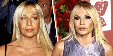 donatella versace before plastic surgery|The Real Donatella Versace .